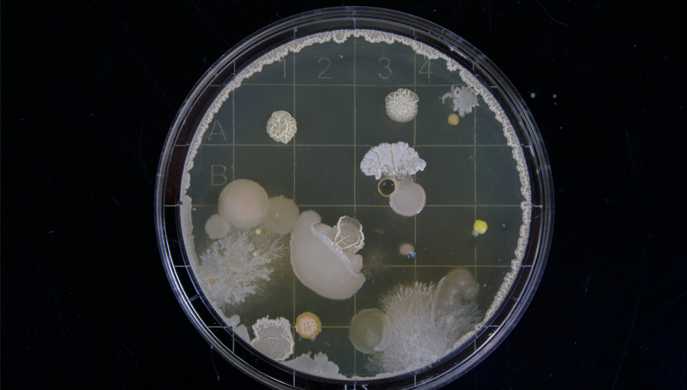 Petri dish with bacteria colony (Photo: Michael Schiffer on Unsplash)