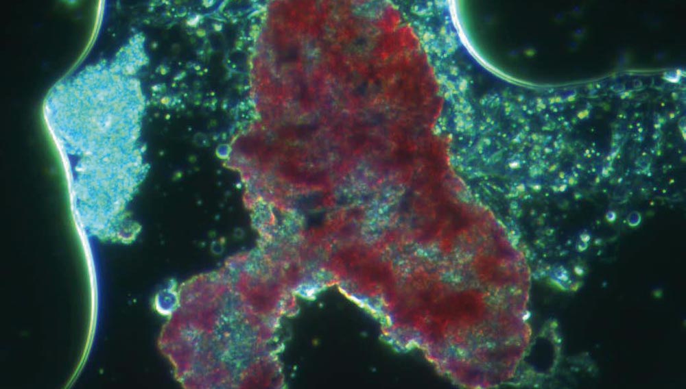 Laugenfiltration in der Flaschenreinigung