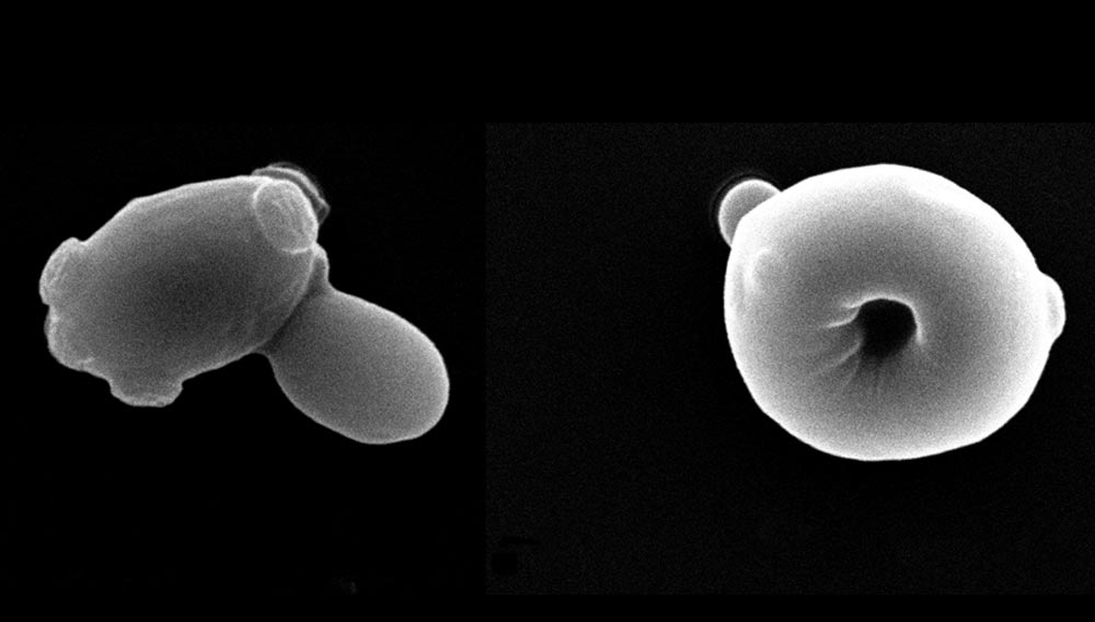 Elektronenmikroskopische Aufnahme von Hefezellen (Foto: Marco Eigenfeld, TU München)