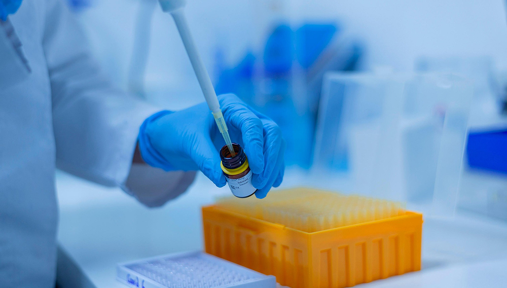 Probenahme mit Pipette in einem Labor (Foto: Fernando Zhiminaicela auf Pixabay)